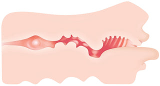 Medicinsk illustration av ett tvärsnitt av en mun med inflammerat tandkött, infektion och en mjuk tunga för realism, inspirerad av Real Mouth Masturbator Evolved.