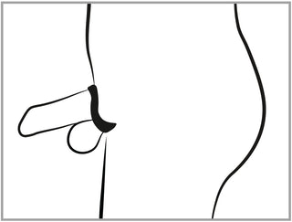 En enkel svart linjeteckning i profil visar manliga könsorgan försedda med Cock Cage med Dilator på underkroppen, mot en vit bakgrund.